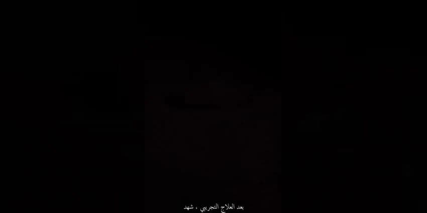 غلاف الفيديو